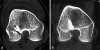 Fig. 3A–B