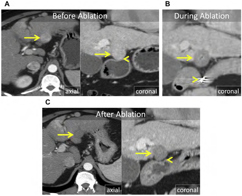 Fig. 21.