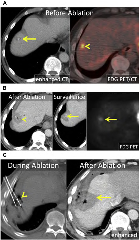 Fig. 16.