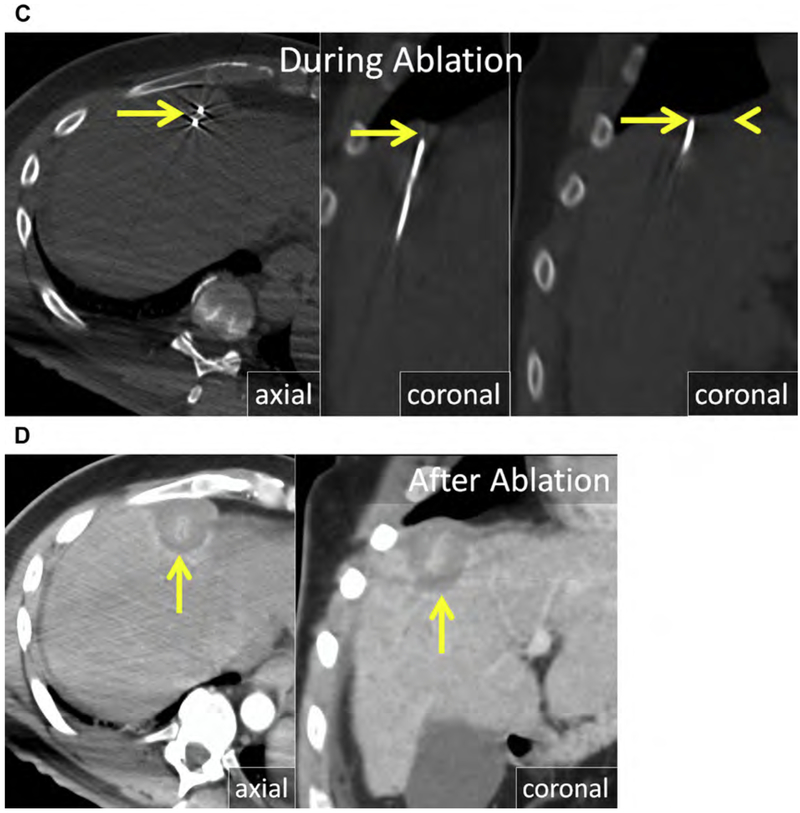 Fig. 20.