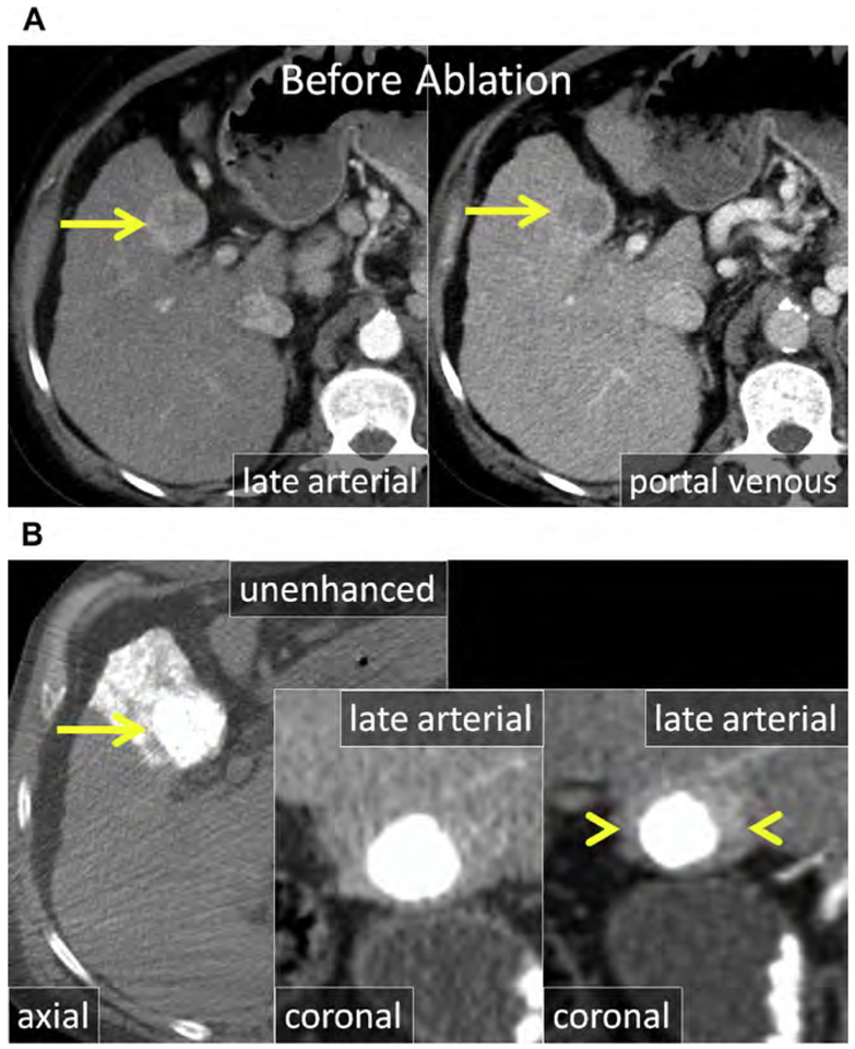 Fig. 14.