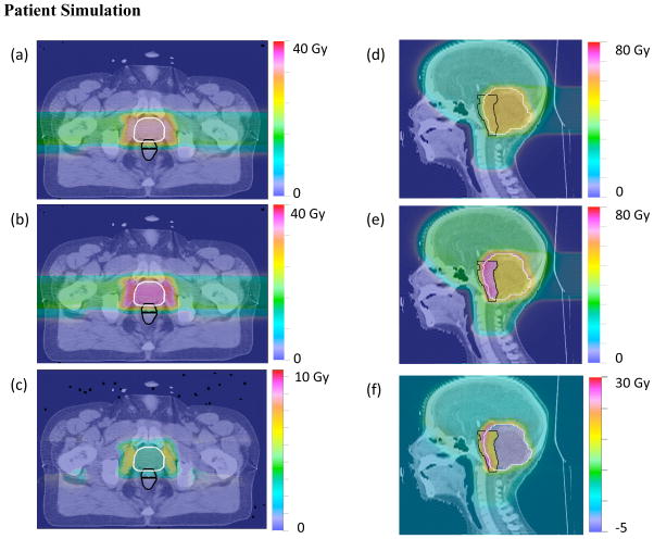 A phenomenological relative biological effectiveness (RBE) model for ...