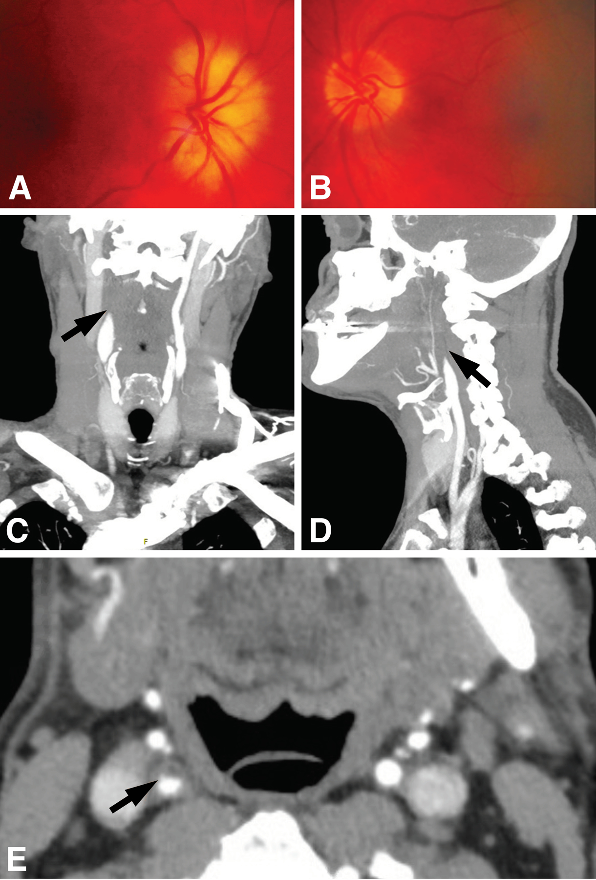 Figure 2: