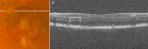 Figure 11.