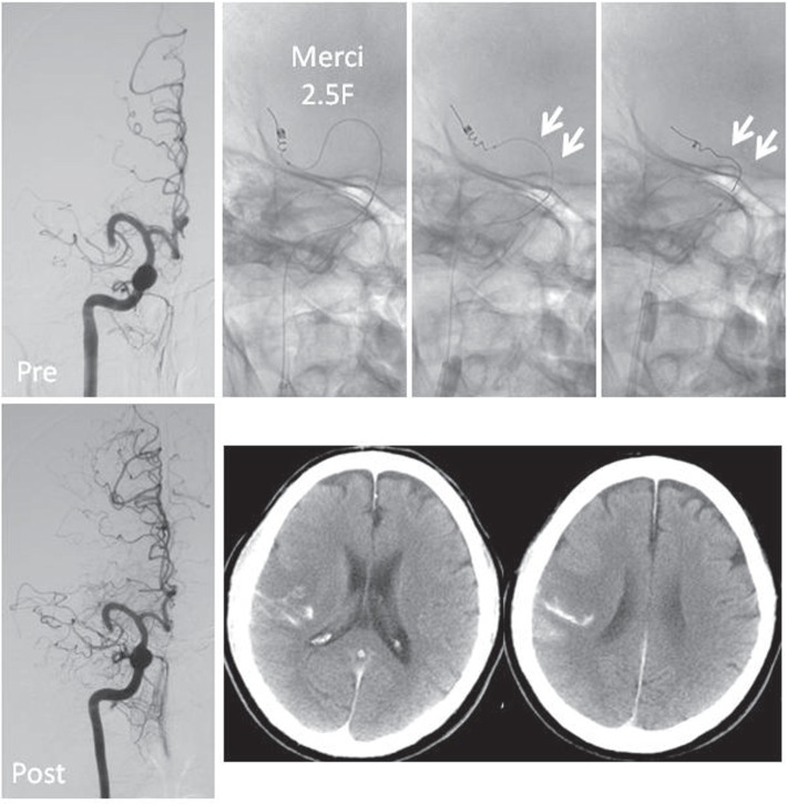 Fig. 2