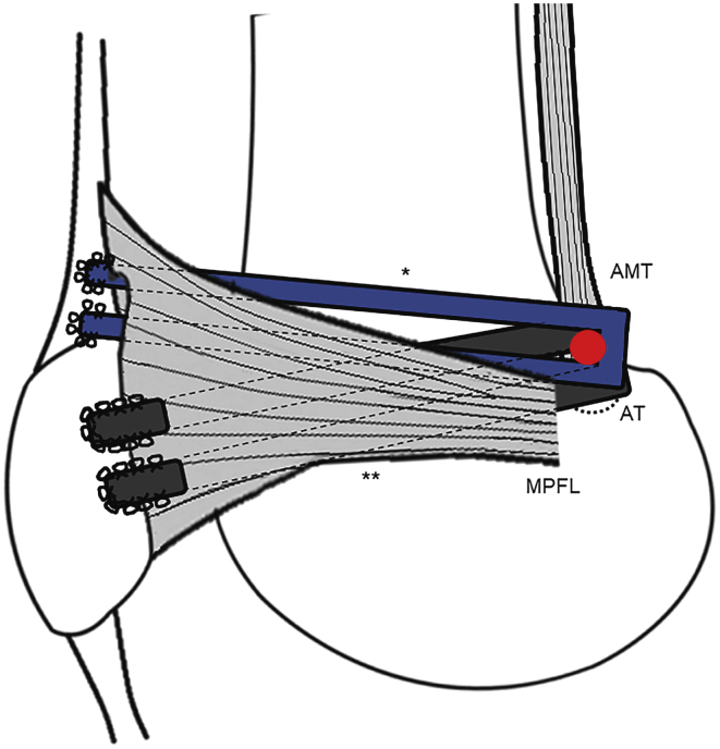 Fig 17