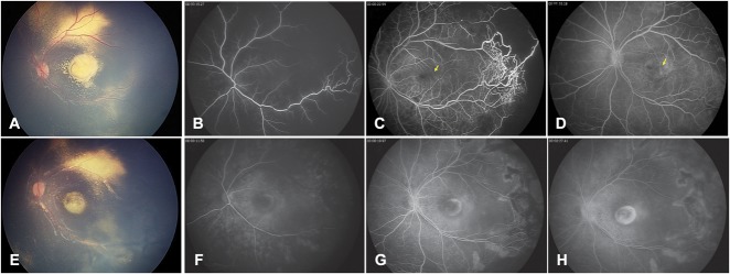 Fig. 2.