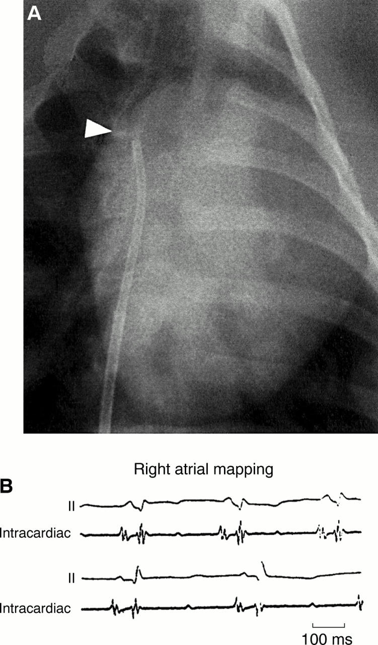 Figure 1  