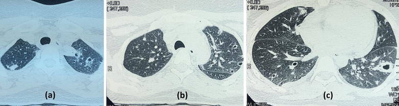 Fig. 2