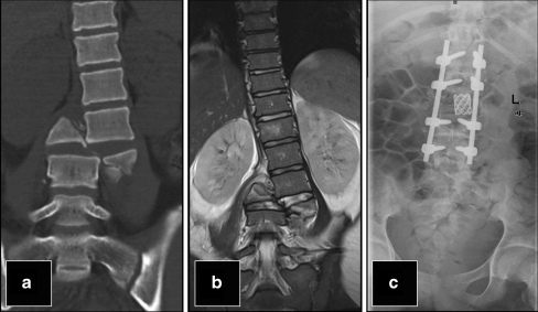 Fig. 2