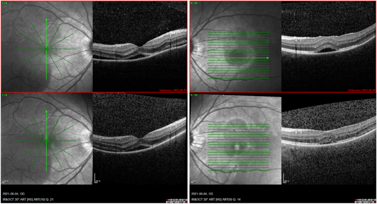 Fig. 4