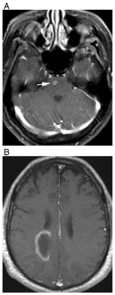 Fig. 9