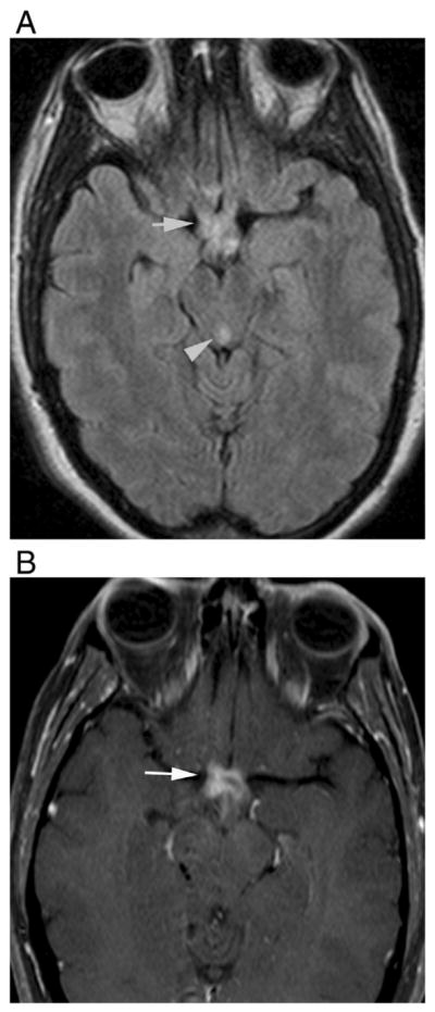 Fig. 10