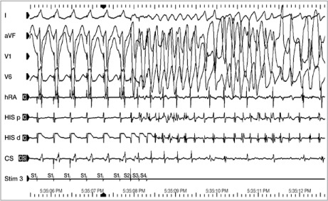 Fig. 2.