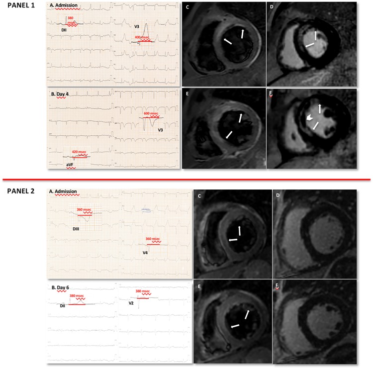 Fig 3