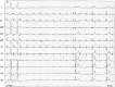 Figure 5b