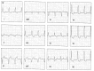 Figure 5a
