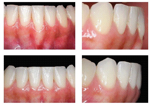 Figure 11