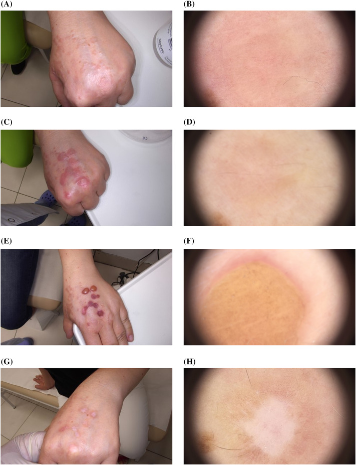 Fig. 6