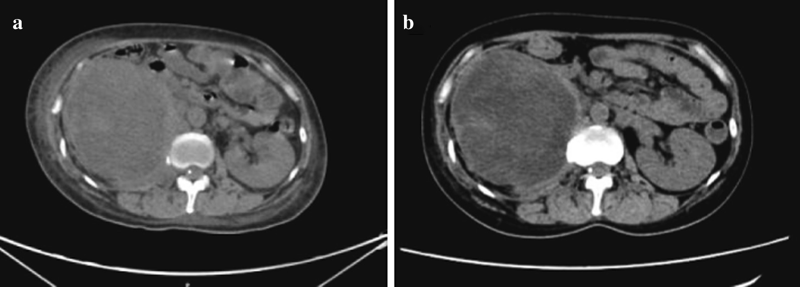 Fig.4