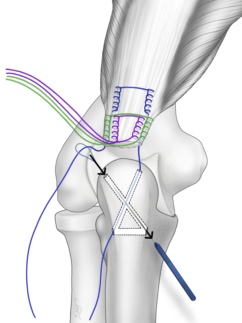 Fig 6