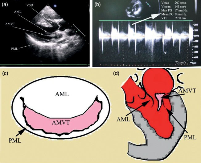 Figure 1: