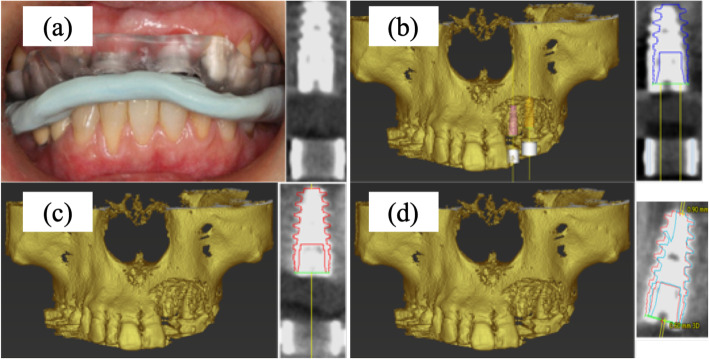 Fig. 1