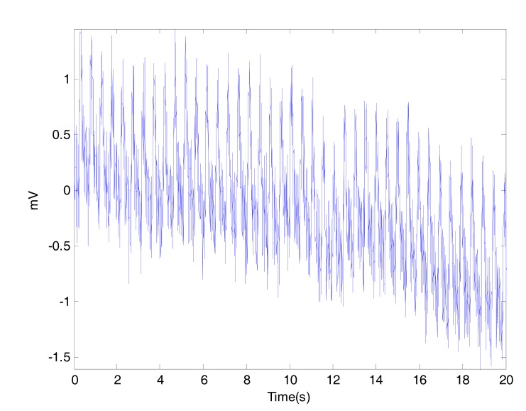 Fig. (4)