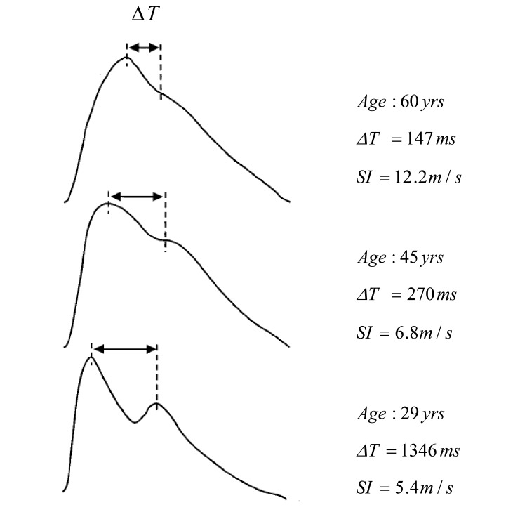 Fig. (13)