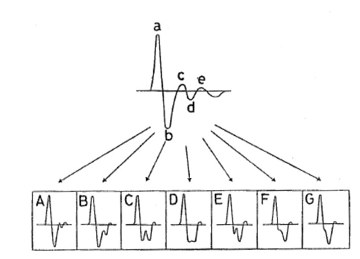 Fig. (16)