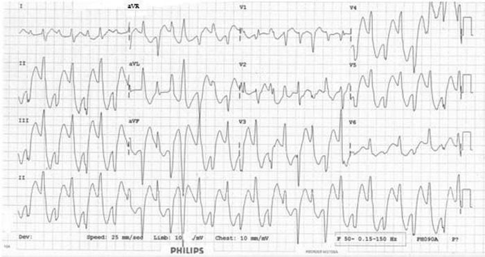 Figure 1