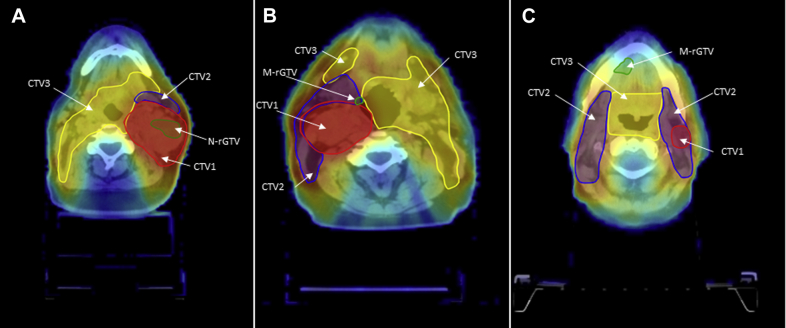 Figure 1