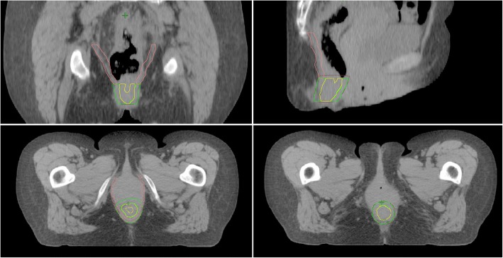 Fig. 1