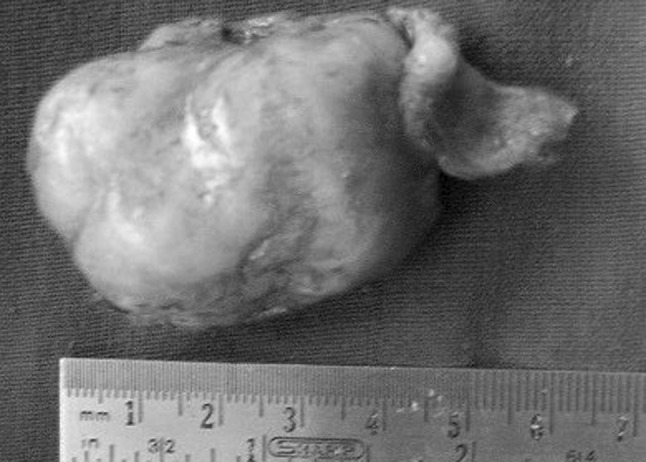 Fig. 2
