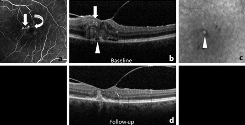 Fig. 2