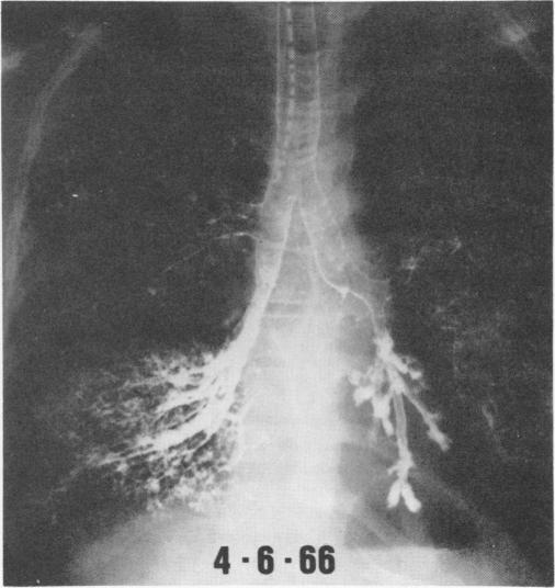 Fig. 3C.