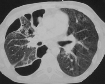 Figure 23