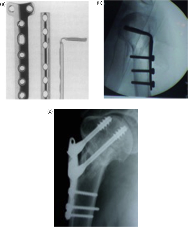 Fig. 1