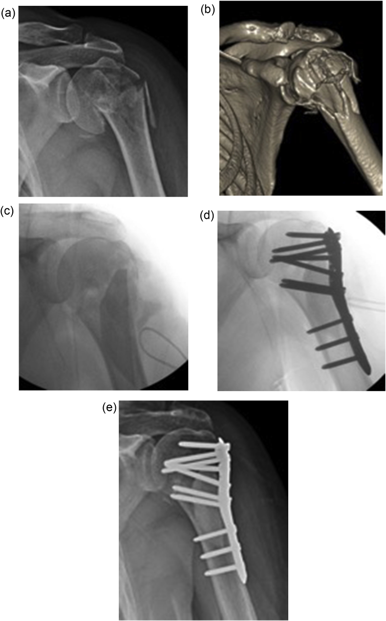 Fig. 2