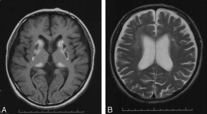 Fig 2.