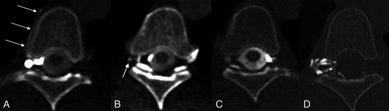 FIG 2.