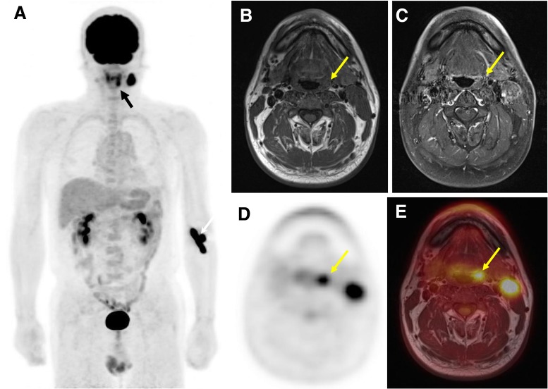 Fig. 2