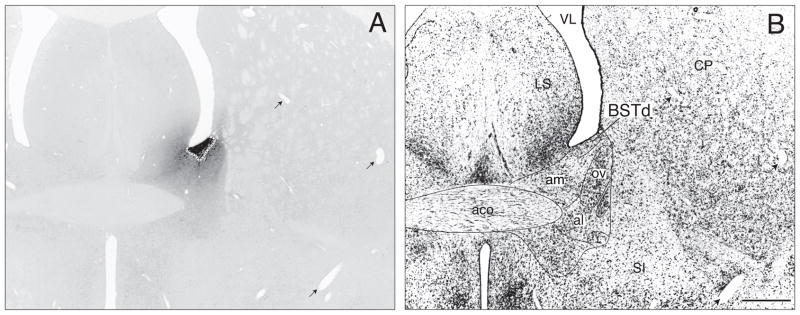 Fig. 13