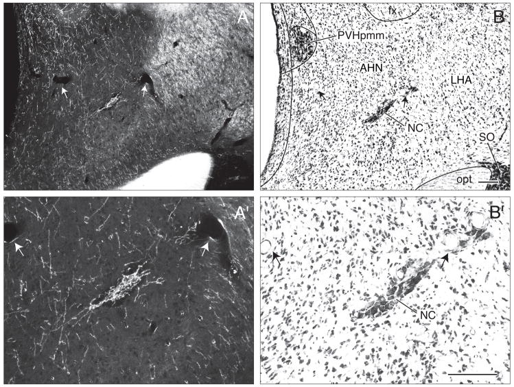 Fig. 12