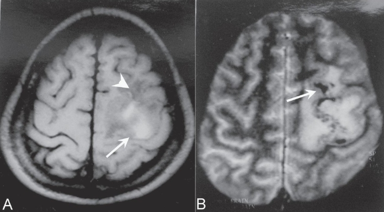 Figure 1 (A, B)