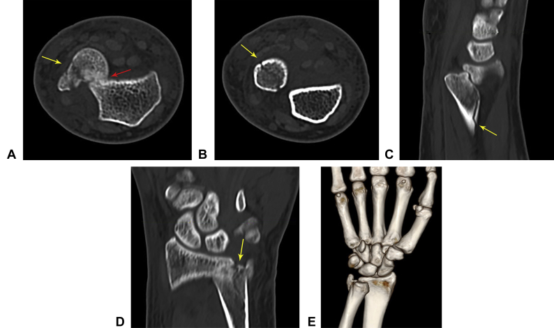 Figure 2