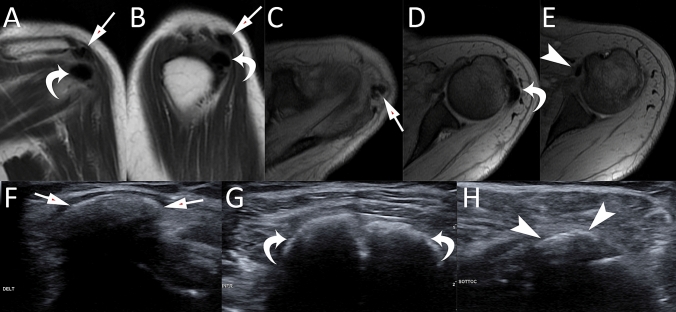 Fig. 12