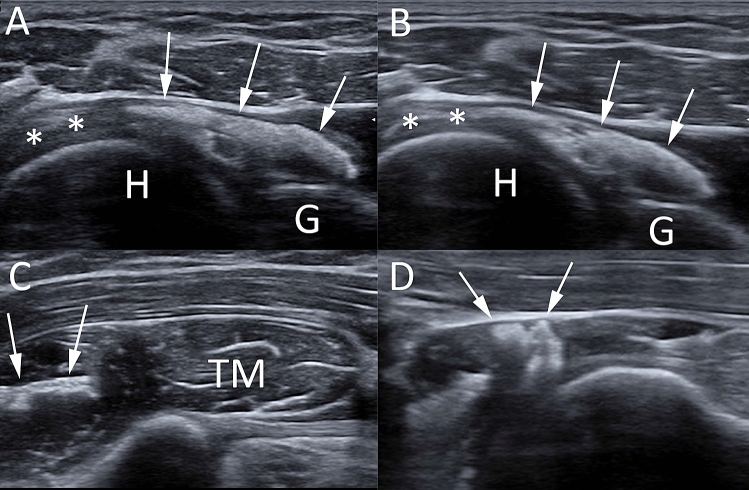 Fig. 9