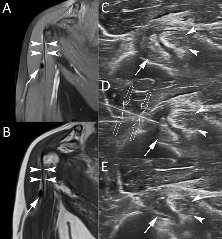 Fig. 10