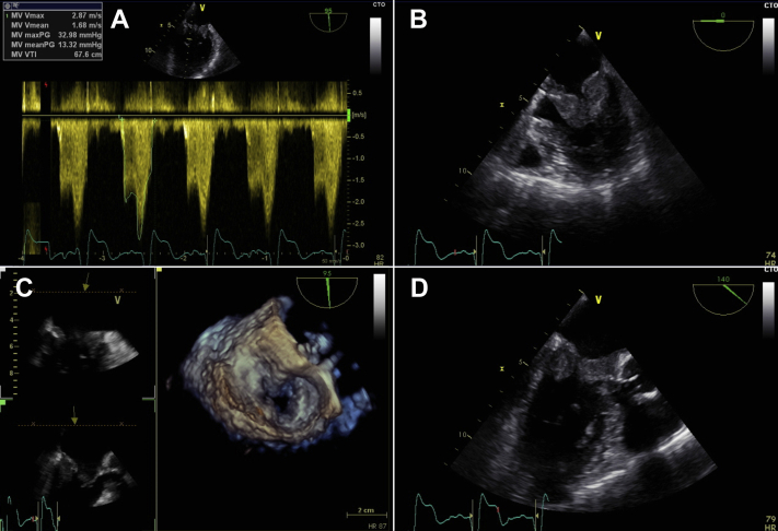 Figure 1